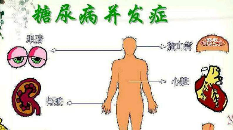 糖尿病并发症的严重性