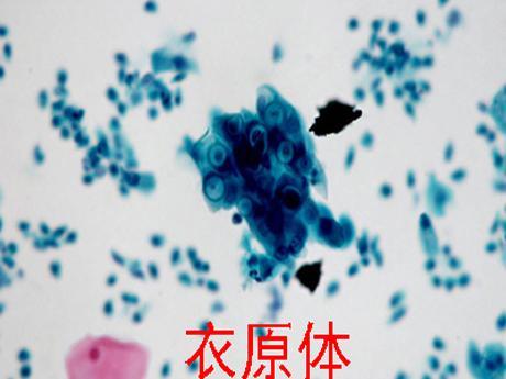 衣原体传播途径与危害