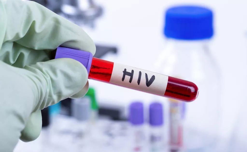 1,血液或体液中的hiv抗体检验