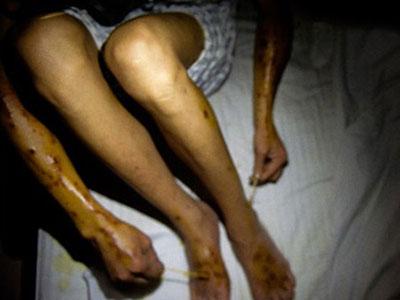 戒毒医院心理康复专家说,冰毒其实最初是在日本研发而成的,二战由日本