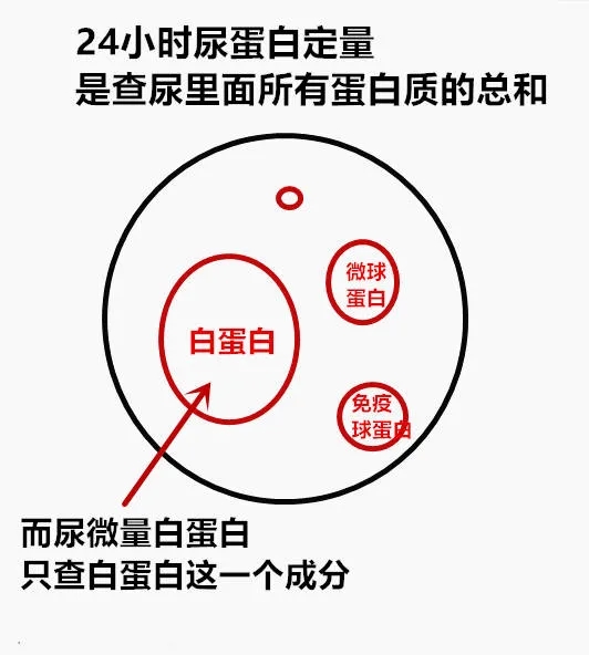 尿微量白蛋白检测的原因