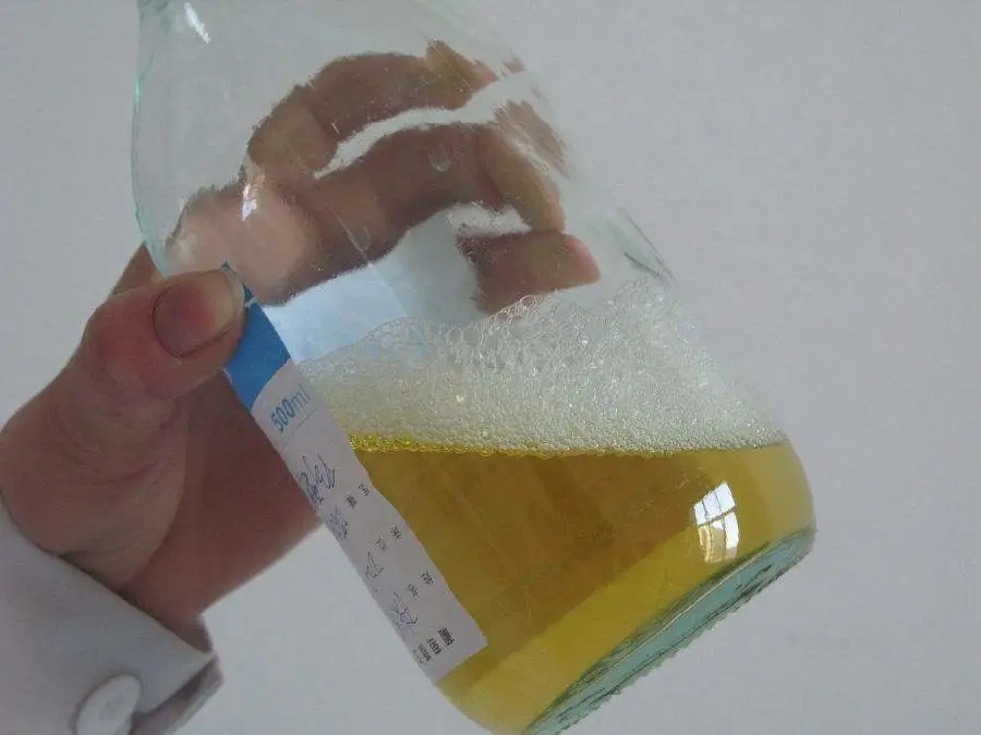 正常情况下,人体也会有少量的蛋白排出,这种暂时性出现蛋白尿的情况会